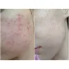 اسنس ضد التهاب و قرمزی ماگورت آیم فرام
