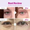 کرم دور چشم کلسیم دارک اسپات دکتر ملاکسین ضد چروک و روشن کننده قوی