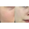 تونر اسنس آبرسان و تسکین دهنده پیونکانگ یول