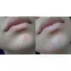 کرم نقطه ای ضد لک و جوش تیام