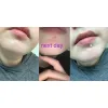 لوسیون نقطه ای ضد لک و جوش کوزارکس