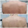 شوینده بدن ضد جوش و آبرسان 30 روزه میراکل سام بای می