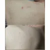 شوینده بدن ضد جوش و آبرسان 30 روزه میراکل سام بای می