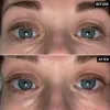 Retinol Eye Cream before and after results