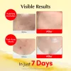 Vitamin illuminating Cream