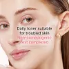 PDRN Pink Niacinamide Milky Toner - medicube.us