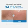 Zero Pore Blackhead Deep Cleansing Oil - medicube.us