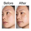  Before and After of customer using Hyaluronic Acid Serum