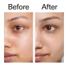 Before and after of customer using Caffeine Eye Cream
