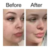Before and after of customer using Omega Water Cream