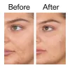 Salicylic Acid Cleanser - 150ml