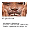 Person applying Salicylic Acid Cleanser text highlighting product benefits