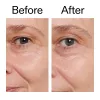 Before and after comparison of a person's eye area with visible aging signs.