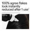 Salicylic Acid Exfoliating Scalp Treatment being applied to scalp with text about flake reduction after one use