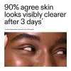 Advertisement with text about skin clarity improvement after 3 days, featuring a close-up of a person's eye.