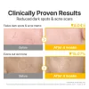 No.5 Vitamin-Niacinamide Concentrated Toner Pads