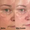 Close-up before-and-after comparison of a person's under-eye area, labeled 'Before' and 'After 4 weeks,' showing a visible reduction in dark circles and puffiness.