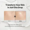 SOS Serum