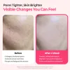 Cemenrete Cyano Pink Spicule Line