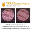 Peel Shot Kojic Acid Turmeric Spray