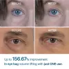Eyephalt eyebag cream