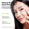 Anua US Moisturizer Azelaic Acid CICA Skin Soothing Moisturizer