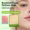 Anua US Ampoule/Serum Azelaic Acid 10 Hyaluron Redness Soothing Serum