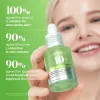 Anua US Ampoule/Serum Azelaic Acid 10 Hyaluron Redness Soothing Serum