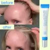 Scalpy Hair Serum